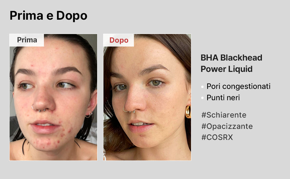 COSRX Liquidi per eliminare i punti neri BHA 4% 100ml, 4% di BHA (betaina salicilato), aiuta a liberare i pori ostruiti ed esfolia delicatamente le cellule morte della pelle, Ipoallergenico