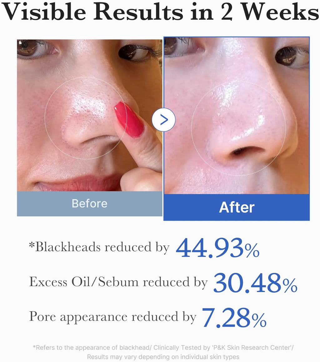medicube Zero Pore Pads 2.0, tamponi toner facciali a doppia texture per esfoliazione e cura dei pori con 4,5% di acido lattico AHA e 0,45% acido salicilico BHA, ideali per tutti i tipi di pelle, cura